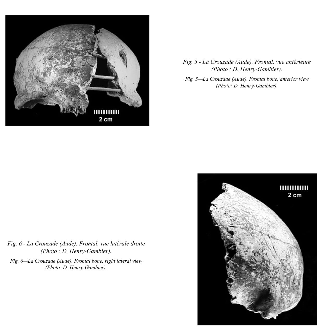 Aurignacien: Frontal et fragment du maxillaire